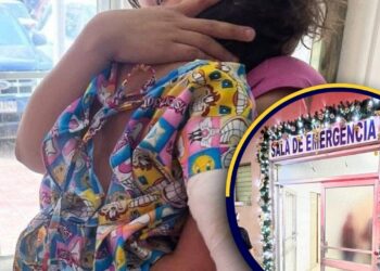 ¡Condenable! Salvaje sujeto, quemó la boca de su hijastro de 2 años con un tizón y le fracturó brazo y pierna