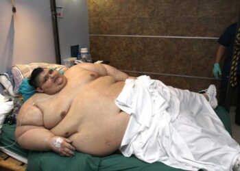 Muere el mexicano Juan Pedro Franco, conocido por haber sido el hombre más obeso del mundo