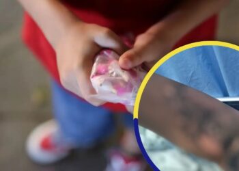 Una menor de 13 años se suma a los quemados por pólvora esta Navidad: sufrió daños en su zona íntima