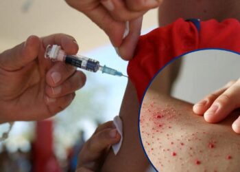 OPS alerta por fuerte aumento de casos de sarampión en las Américas