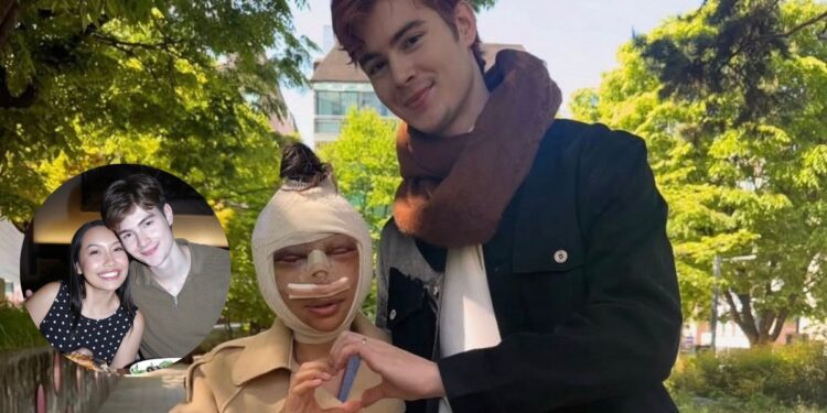 Influencer tailandesa se somete a cirugía facial porque le decían que su esposo era “demasiado guapo para ella”