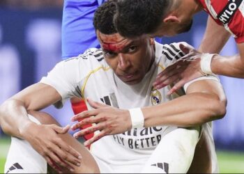 Así terminó el rostro de Mbappé después de un codazo de Vitor Reis en el partido contra Girona