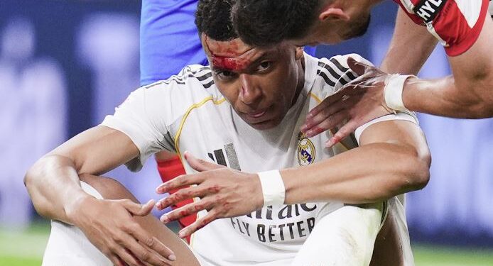 Así terminó el rostro de Mbappé después de un codazo de Vitor Reis en el partido contra Girona
