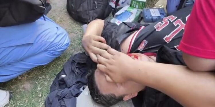 Protesta en los bajos del Congreso Nacional termina en caos, violencia y un estudiante herido