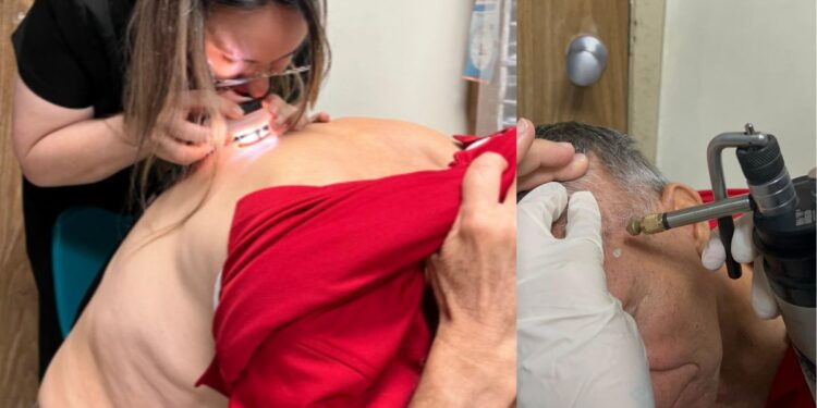 Hospital Escuela realizará Semana de Detección de Cáncer de Piel del 1 al 5 de junio