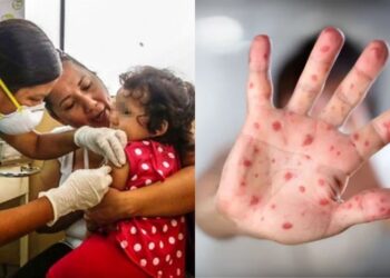 Perú brote de sarampión emergencia