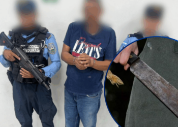 La Policía Nacional captura a hombre acusado de quitarle la mano a una menor en El Progreso
