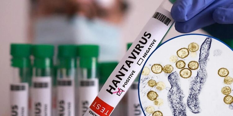 ¡Descartan mutación del hantavirus del crucero! Pertenece a la peligrosa variante Andes