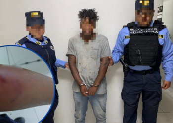 ¡Qué cosas! Capturan a hombre que maltrataba a su esposa y durante su arresto mordió a una funcionaria policial