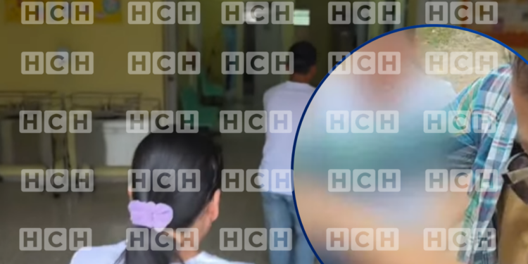 ¡Vivos de milagro! Tres personas resultaron quemadas con pólvora en San Nicolás, Copán