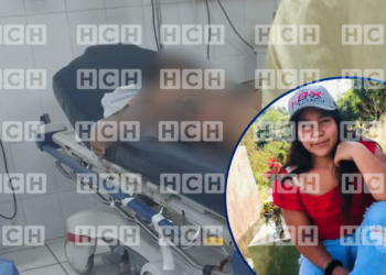 ¡Escalofriante! Fallece una mujer embarazada que sufrió graves quemaduras en Copán
