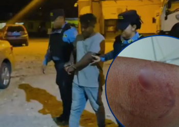 Misquito detenido el fin de semana por violencia doméstica queda preso tras agredir y morder a un policía
