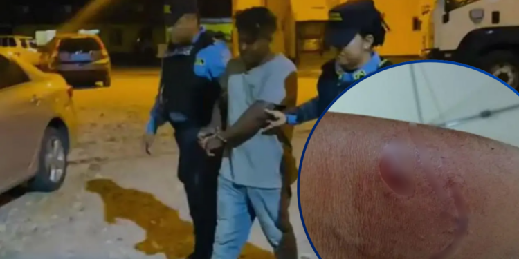 Misquito detenido el fin de semana por violencia doméstica queda preso tras agredir y morder a un policía