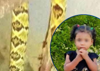Menor de dos años se debate entre la vida y la muerte tras ser atacada por una serpiente en Comayagua