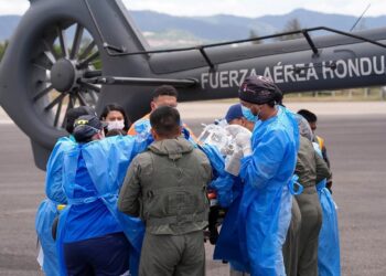 Kenia, la menor quemada tras explosión en fábrica copaneca presenta una evidente mejoría