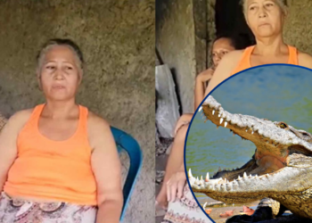 “Llevo 28 años con dos cocodrilos en el estómago”: hondureña atribuye su padecimiento a un acto de brujería