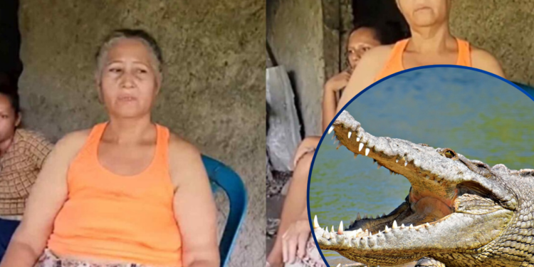 “Llevo 28 años con dos cocodrilos en el estómago”: hondureña atribuye su padecimiento a un acto de brujería