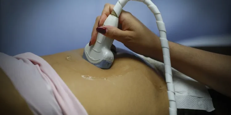La ultraderecha chilena busca obligar a las mujeres a oír el latido del feto antes de abortar
