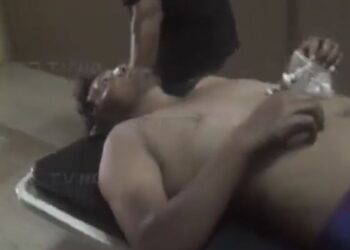 ¡Vivo de milagro! Le hicieron 12 “plomazos” y solamente le pegaron uno en la pierna
